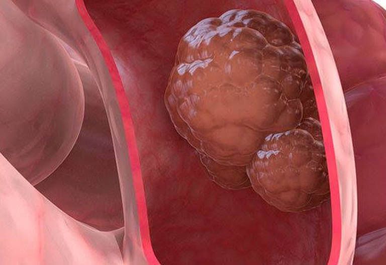 Cách ăn trái cây đúng cách để đạt hiệu quả tốt nhất