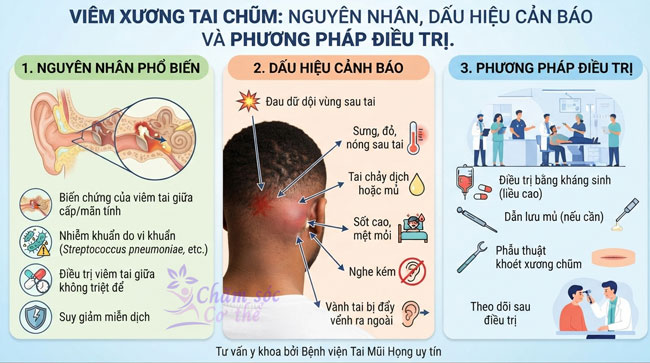 Viêm Xương Tai Chũm: Nguyên Nhân, Dấu Hiệu Cảnh Báo và Phương Pháp Điều Trị