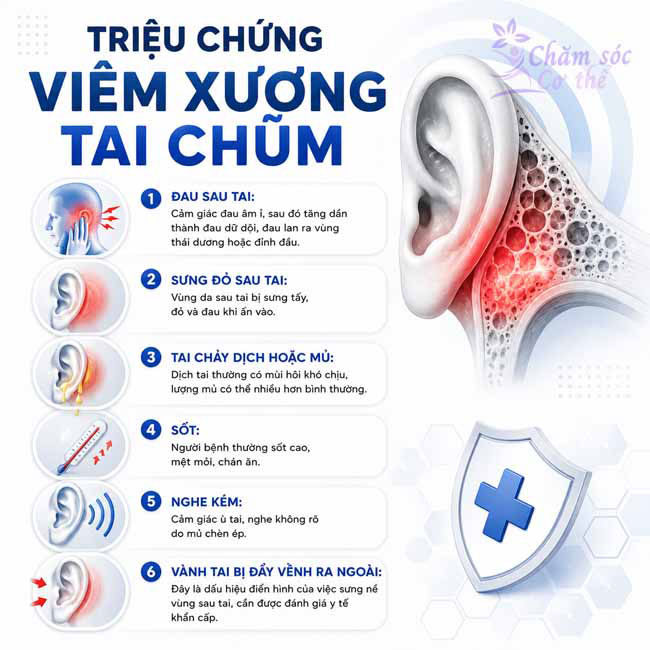 Triệu chứng Viêm Xương Tai Chũm