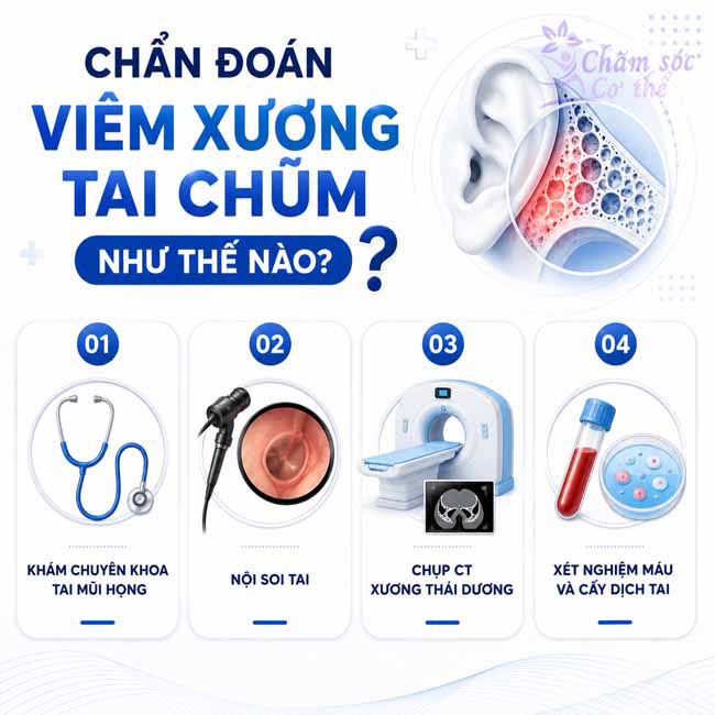 Chẩn đoán Viêm Xương Tai Chũm như thế nào