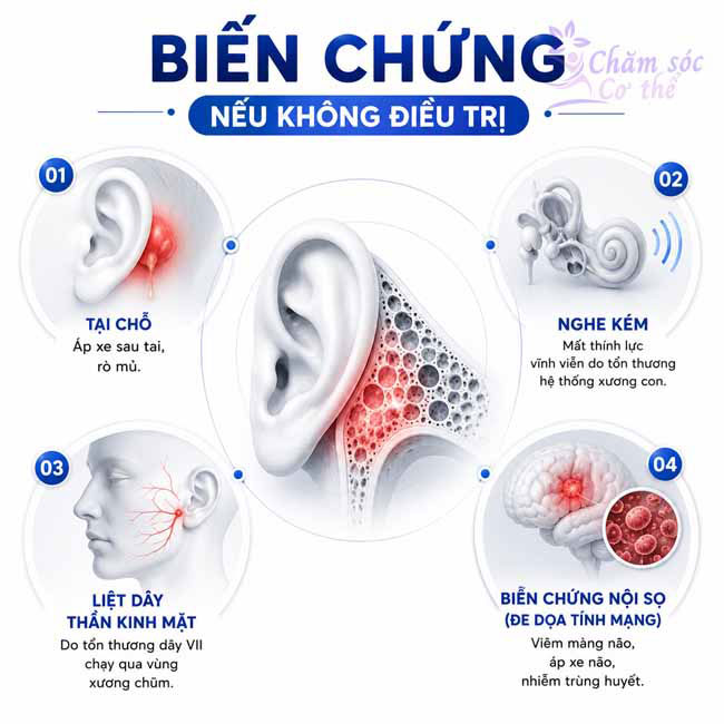Biến chứng nếu không điều trị