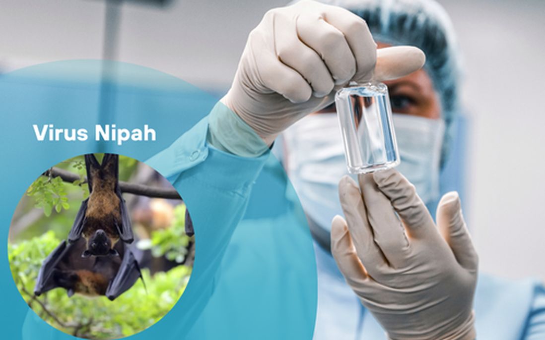 Nipah virus nguy hiểm không